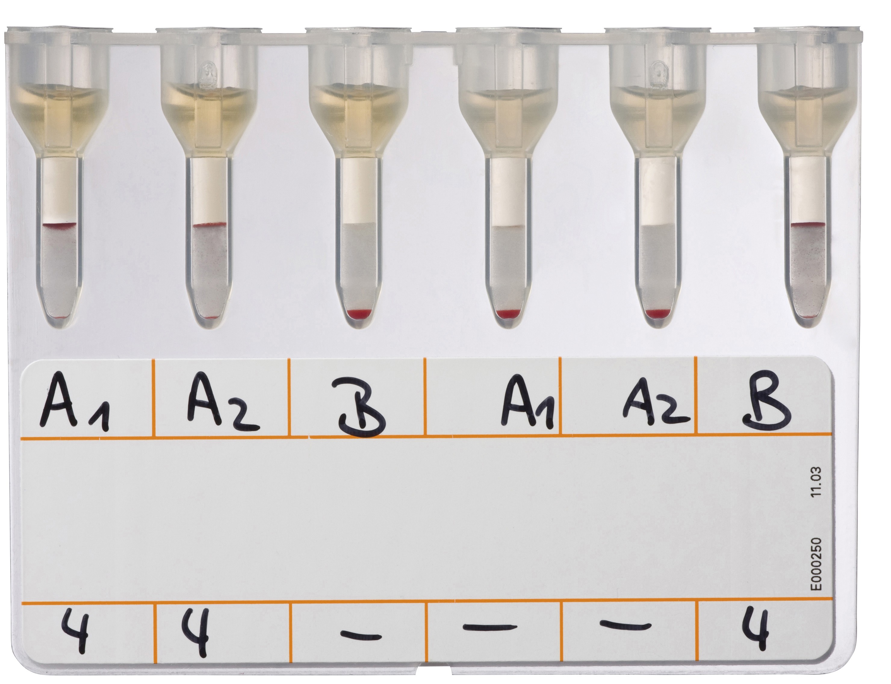 ID-карта NaCl, Enzyme Test and Cold Agglutinins