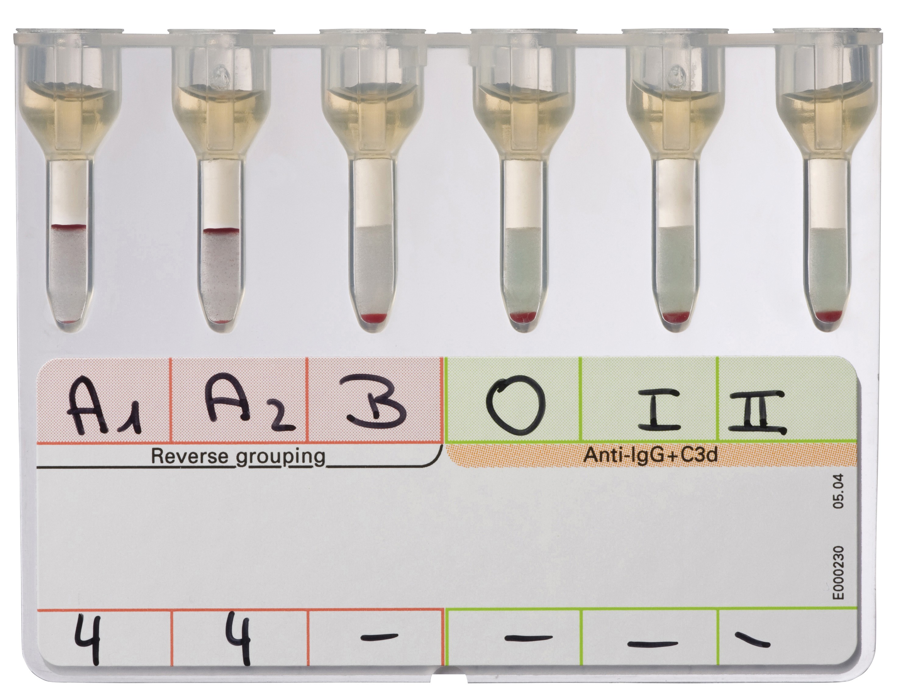 ID-карта Reverse Grouping with Antibody Screening