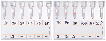 ID-карта NaCl, Enzyme Test and Cold Agglutinins